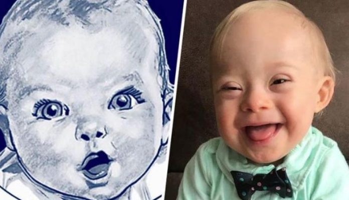 Conoce a Lucas, el primer bebé Gerber con Síndrome de Down