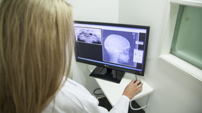 Una mujer pasó dos meses con una bala incrustada en su cabeza sin darse cuenta