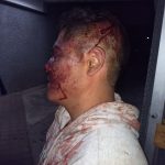 Policía Federal golpea brutalmente a agremiado de la CNTE
