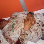 Comuneros de Calzontzin convocan a asamblea tras brutal golpiza a maestro