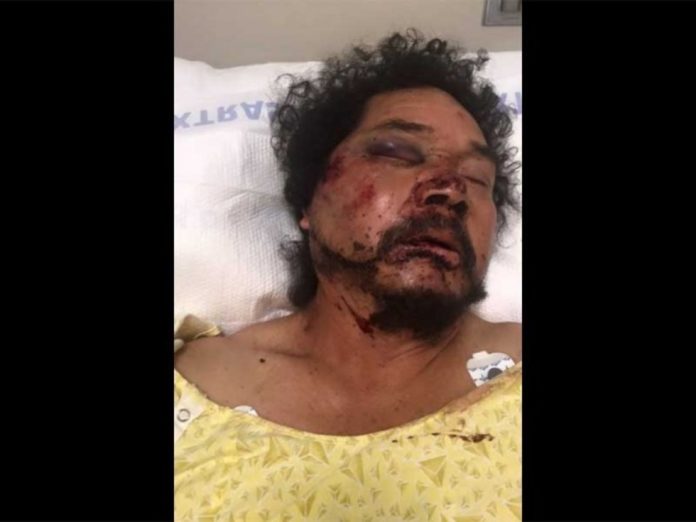 Reúnen 80 mil dólares para indocumentado oaxaqueño golpeado en Los Ángeles