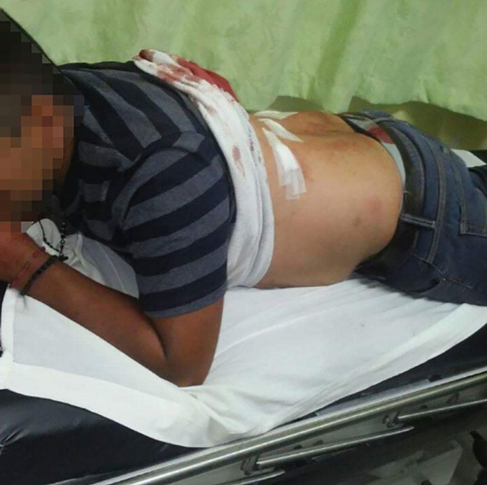 Policía es herido en riña al calor de las copas