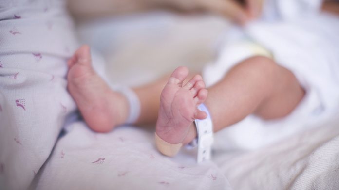 Foto: Nace bebé con cabeza de su hermana adherida al abdomen
