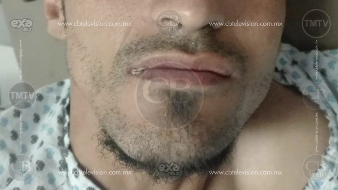 Para cometer robo, balean a  cortador de aguacate en Uruapan
