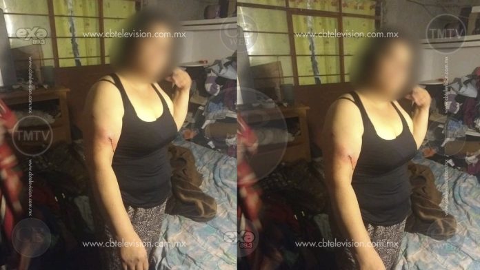 En Morelia madre e hija son atacadas a balazos por el esposo de una en pleito familiar