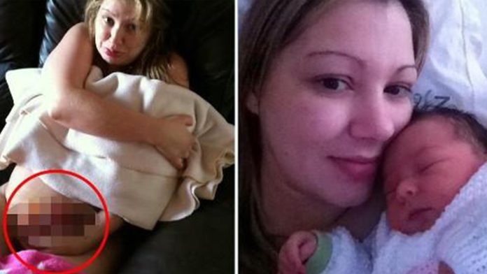 Mujer da a luz y se le salen los intestinos cinco días después