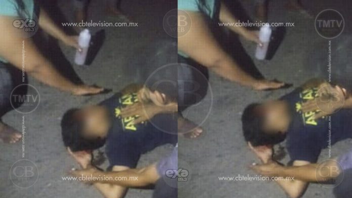 Se accidenta adolescente que viajaba en bicicleta