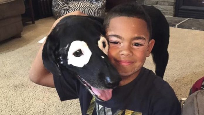 Niño sale de depresión al conocer a perro con su misma enfermedad