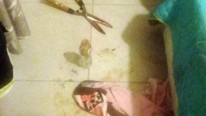 Mujer corta el miembro a su marido por abusar de ella y su hijo