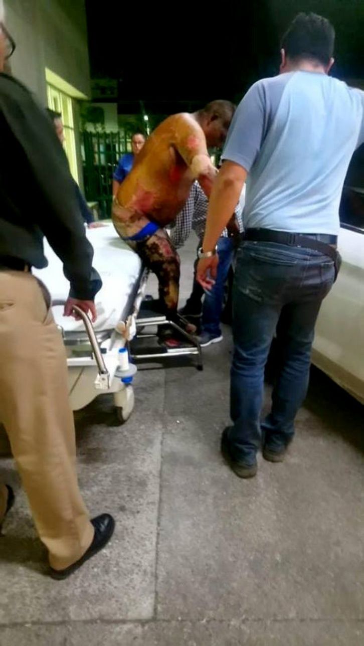 La vida por la gasolina, las trágicas fotos que dejó la explosión