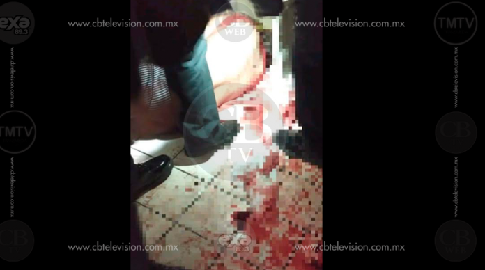 Mujer es herida gravemente con un arma blanca en un pleito marital