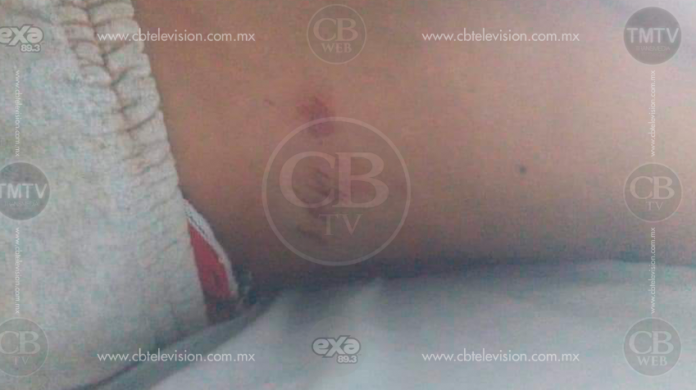 Atropellan a niño de 7 años en San Felipe Los Alzati
