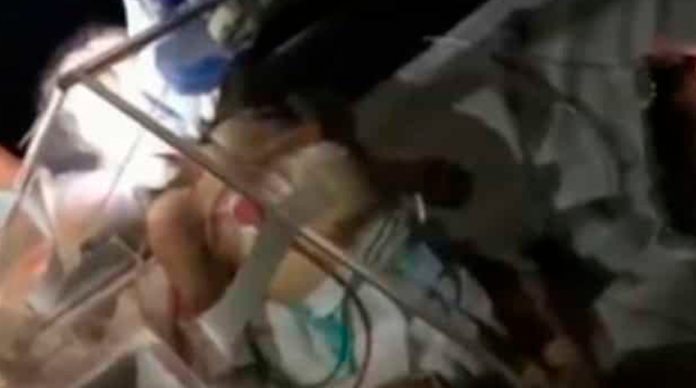 VIDEO: Bebé se debate entre la vida y la muerte tras apagón en Venezuela