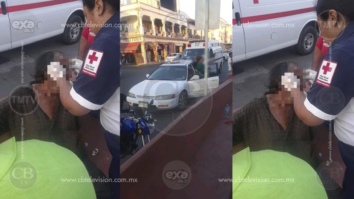 Anciano queda lesionado al ser atropellado por un auto