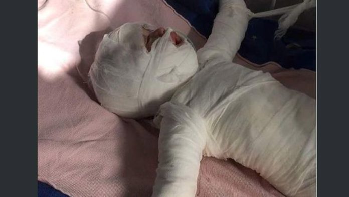 Bebé muere al caer en un balde de agua hirviendo