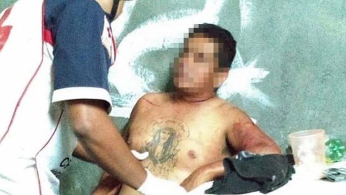 Otra mujer apuñala a su pareja en Iguala