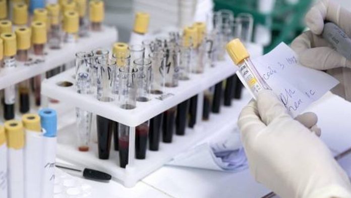 Una tercera persona podría haberse curado de VIH