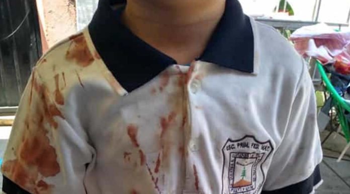 Golpean a niño de primaria hasta dejar su playera llena de sangre
