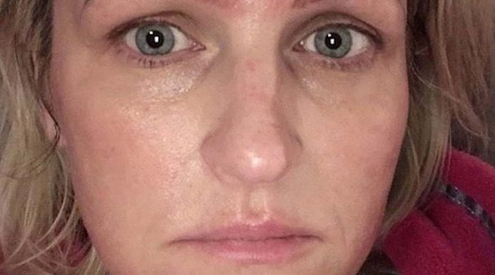 Luego de hacerse el microblading termina con cuatro cejas y sin pareja