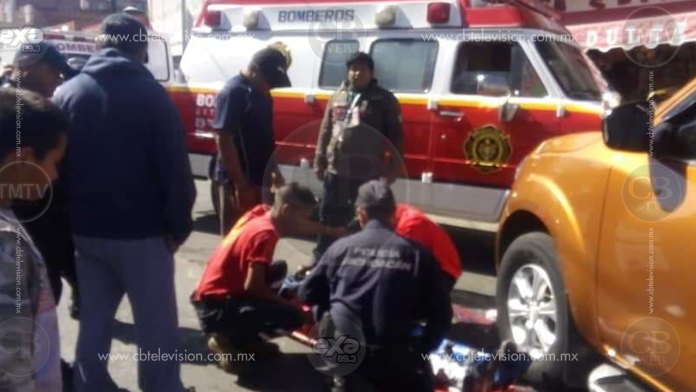 Mujer de la tercera edad queda herida al ser atropellada