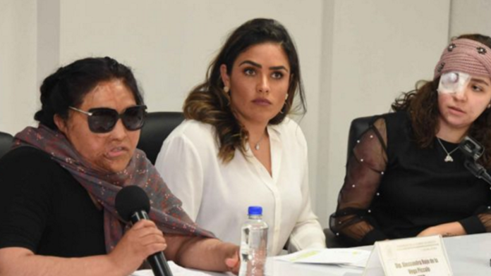 Mujer que fue atacada con ácido vuelve a ser agredida tras denunciar en medios de comunicación