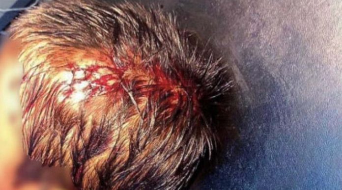 Hombre hiere a machetazos en la cabeza a un menor de edad  