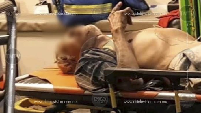 Hieren a anciano en el cuello y lo dejan tirado en la vía pública