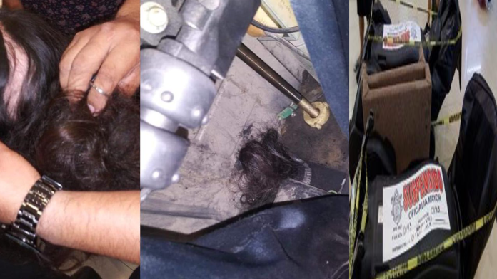 Sillón de masajes falla y le arranca el cabello a una adolescente