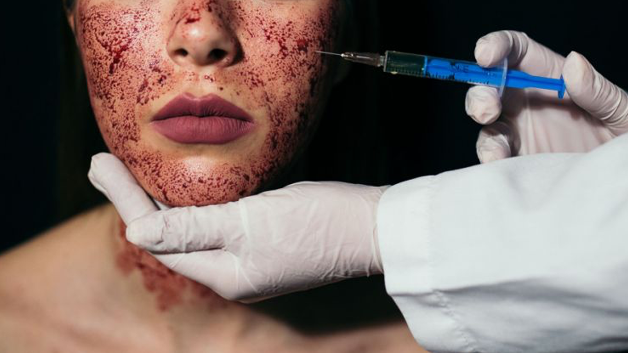 Mujeres contraen VIH por "facial vampiro" Mujeres contraen VIH por "facial vampiro"