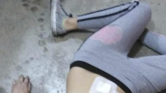 Muere su amiga durante una fiesta; los descubren cuando iban a abandonar el cadáver