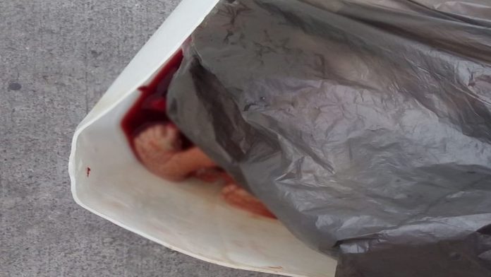 Abandonan a recién nacido en la basura de un hospital