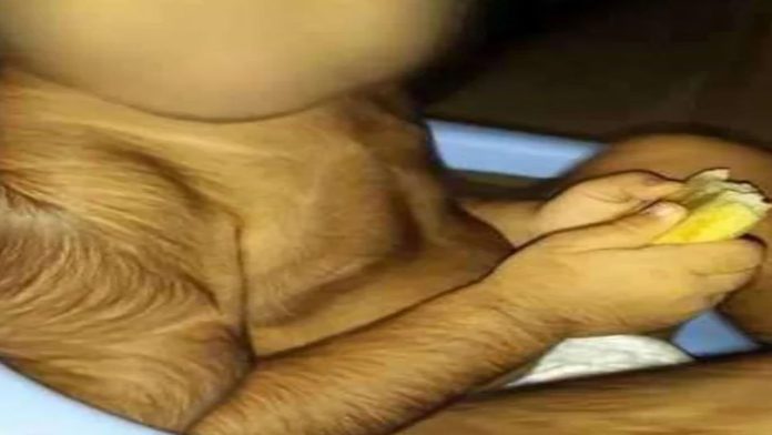 Niños desarrollan el síndrome del hombre lobo tras tomar medicamento contaminado  