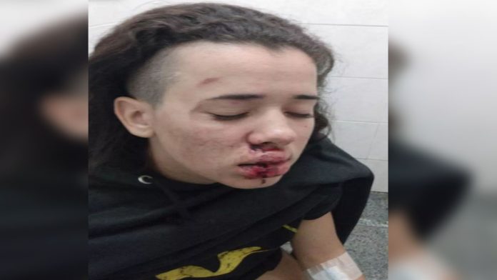 “Quieres ser hombre, responde como hombre”; golpean brutalmente a joven lesbiana