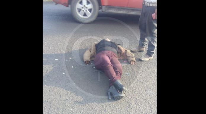 Fémina derrapa en motocicleta y se lesiona un brazo