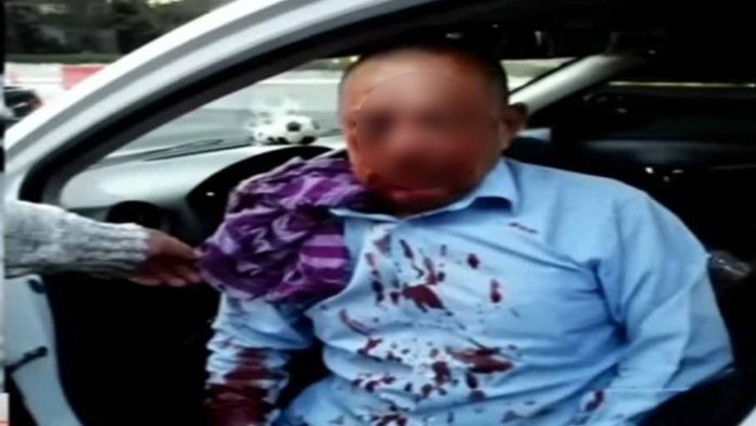 Taxista muere tras ser golpeado por pasajeros que se negaron a pagar el servicio