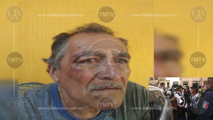 Tras ser detenido y golpeado por Policías de Morelia, Antonio pide justicia