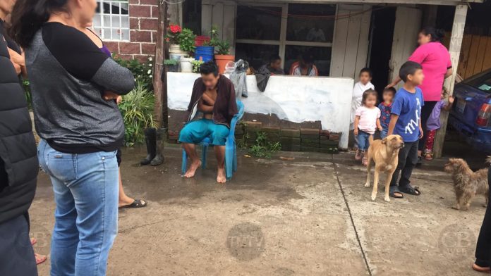 Le cae un rayo y vive para contarlo