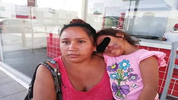 México: Niña de tres años termina en el hospital tras ser golpeada en el kínder