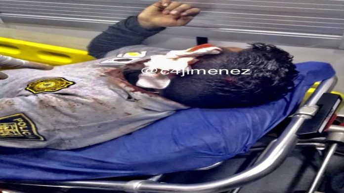 Sujetos agreden a policías para evitar alcoholímetro