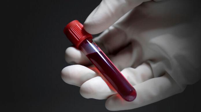 Científicos crean sangre artificial compatible con todos los grupos sanguíneos