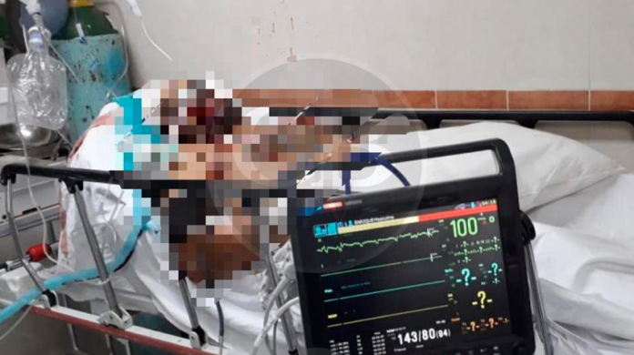 Lo rematan a balazos en el hospital