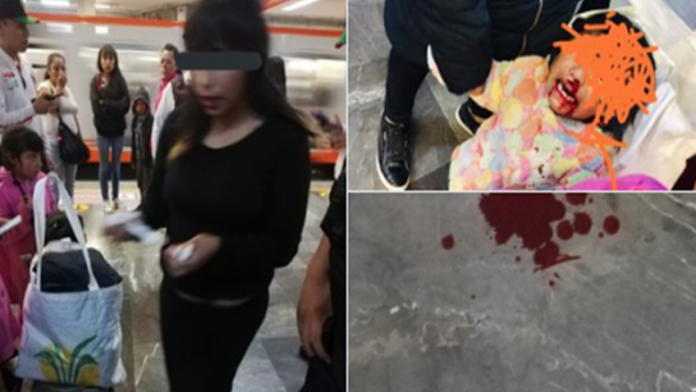 CDMX: Mujer fractura la nariz de su hija de 2 años a golpes