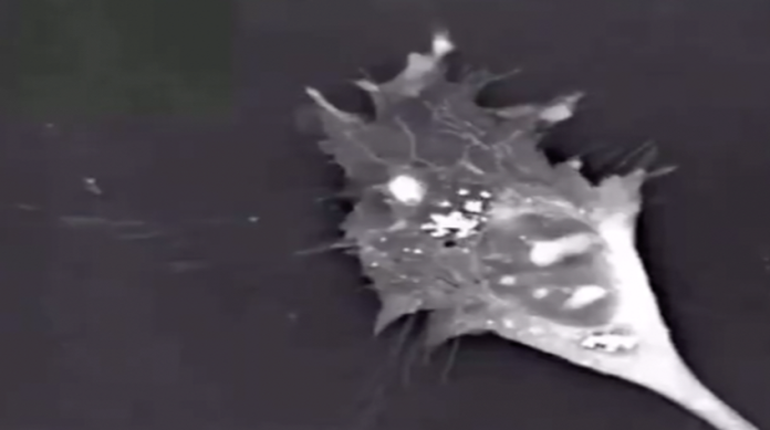 VIDEO: Así se ve la muerte de una neurona