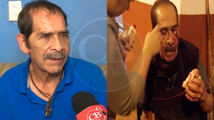 Un mes en cama por operación a José Manuel, vendedor agredido por estudiante