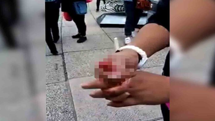 México: Mujer pierde el dedo durante riña con policías (video)