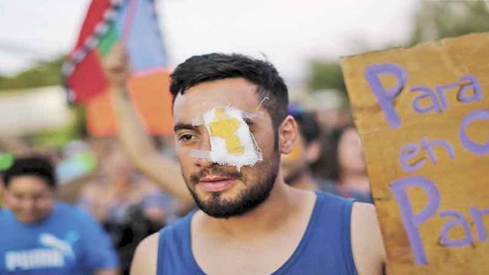 Suman 200 personas con daños oculares tras represión en Chile