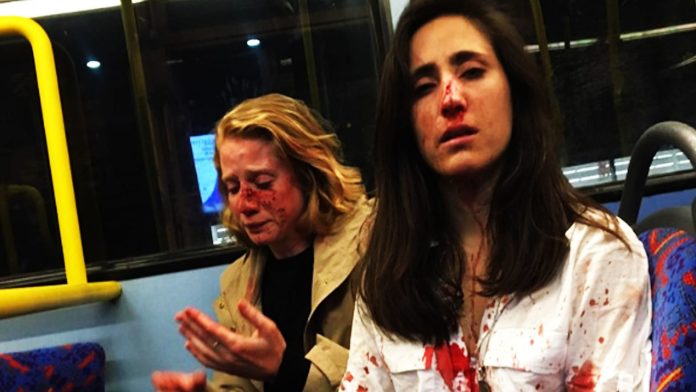 Adolescentes se declaran culpables por golpear a pareja de lesbianas