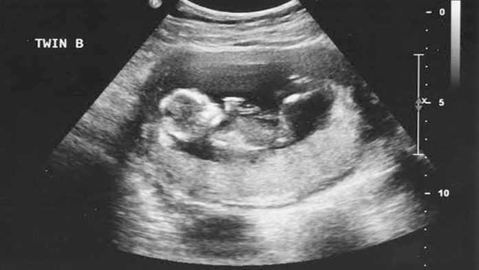 Proponen ley para obligar a las mujeres a ver la foto de su feto antes de abortar