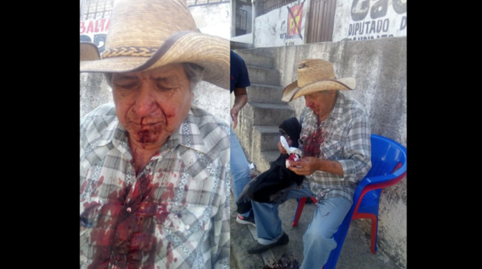 ATENCIÓN MORELIA: Piden ayuda para localizar a la familia del señor Filiberto