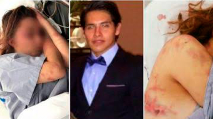 Karateka que dio brutal golpiza a su novia queda en libertad